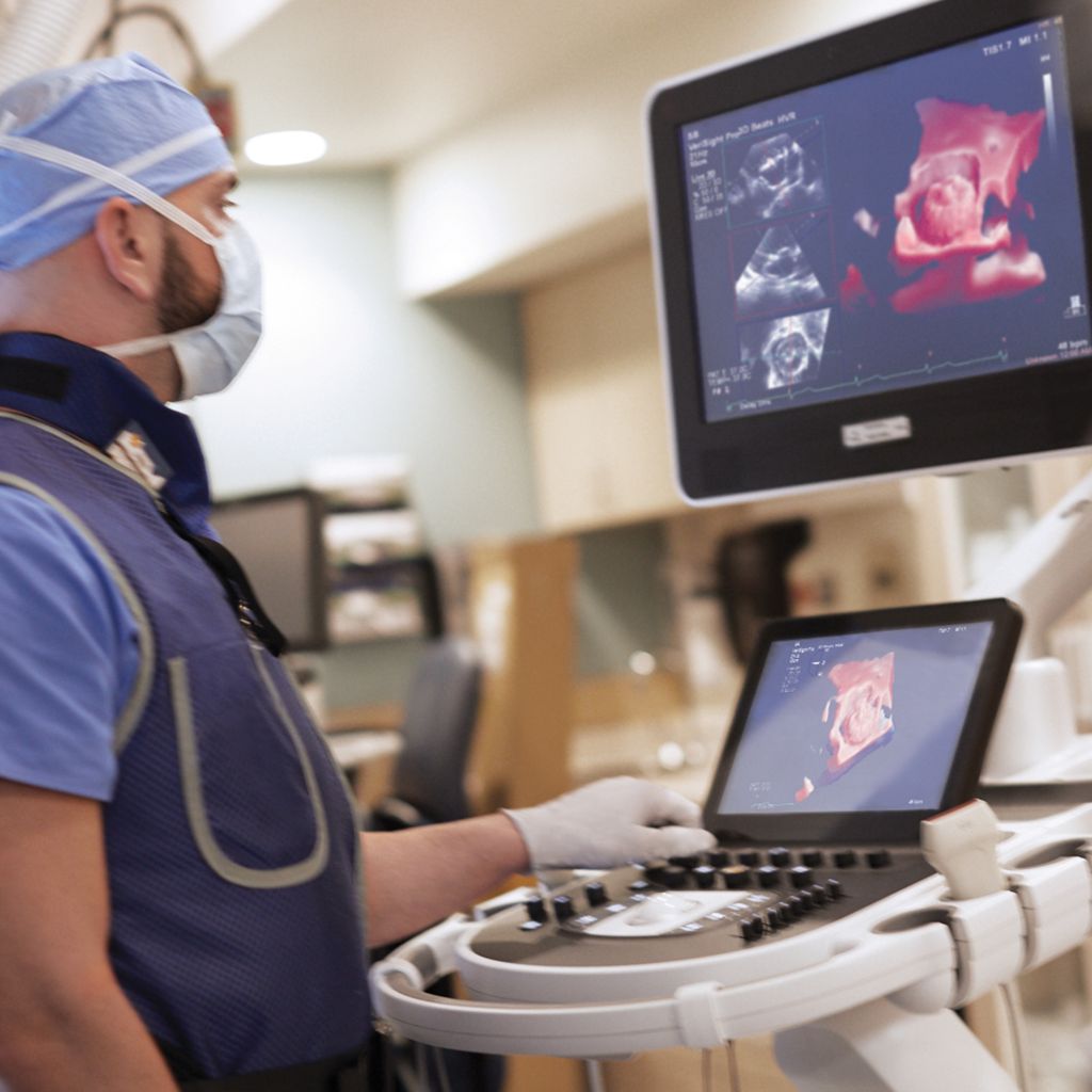 VeriSight Pro 3D ICE LAAO on EPIQ Ultrasound Machine in EP Lab