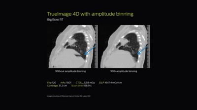 Ct Scan Service Manual Pdf - ct scan machine