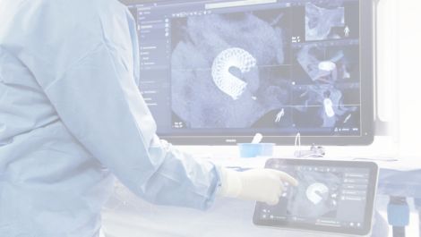 VasoCT Herramienta intervencional