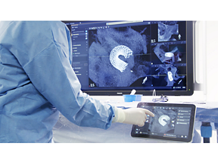 VasoCT Tecnologia di imaging ad alta risoluzione per i tessuti molli