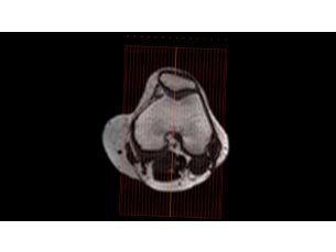 SmartExam Knee MR Clinical application
