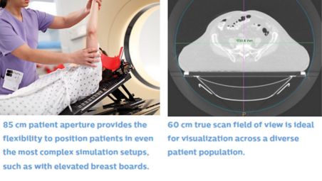 Focusing on what matters in radiation oncology 