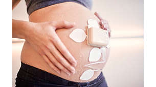 Avalon beltless fetal monitoring solution 