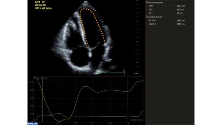 Automated 2D Cardiac Quantificationᴬᴵ (a2DQᴬᴵ)