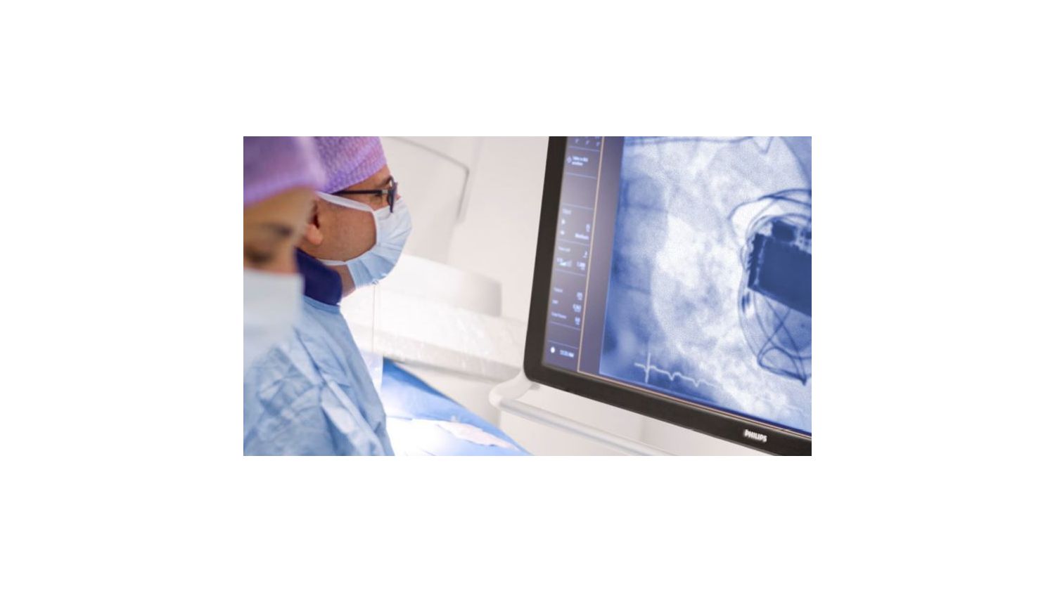 Still image of CIED Infection Motion Graphic