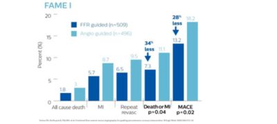iFR Coronary Physiology