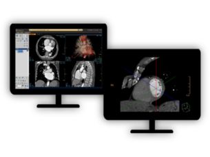 CT Cardiac Viewer​ Quick cardiac visualization