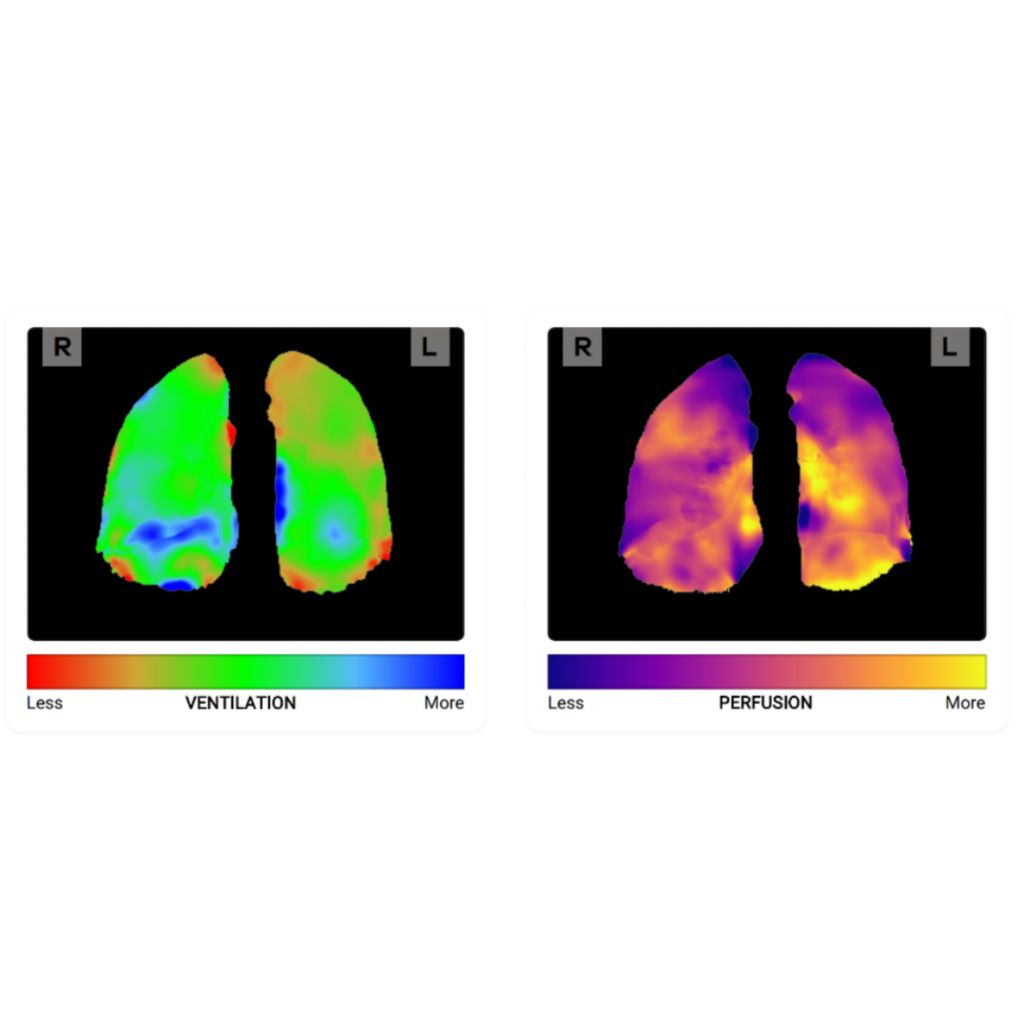 Helps to reduce supply savings