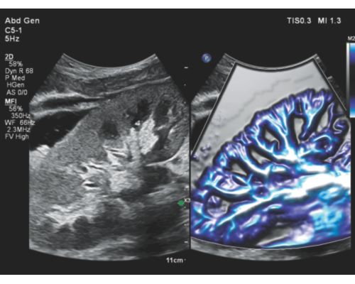 Vasc Carotid Vertebral FV