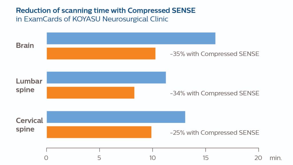 Diagram of reduction of scanning time with Compressed SENSE
