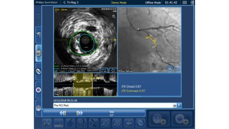 Quickly determine procedural objectives