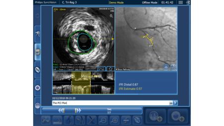 Quickly determine procedural objectives