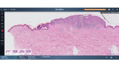Enhancing tissue analysis with a dedicated slide viewer