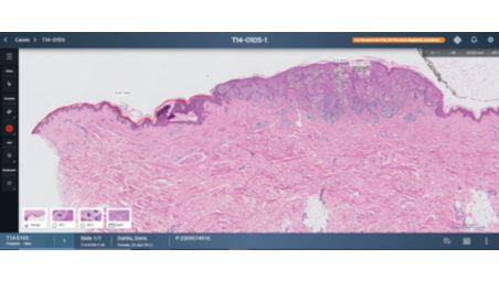 Miglioramento dell'analisi del tessuto con un visualizzatore di vetrini dedicato