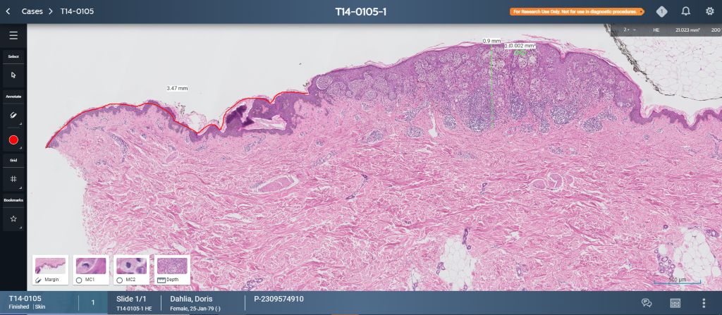 Enhancing tissue analysis with a dedicated slide viewer