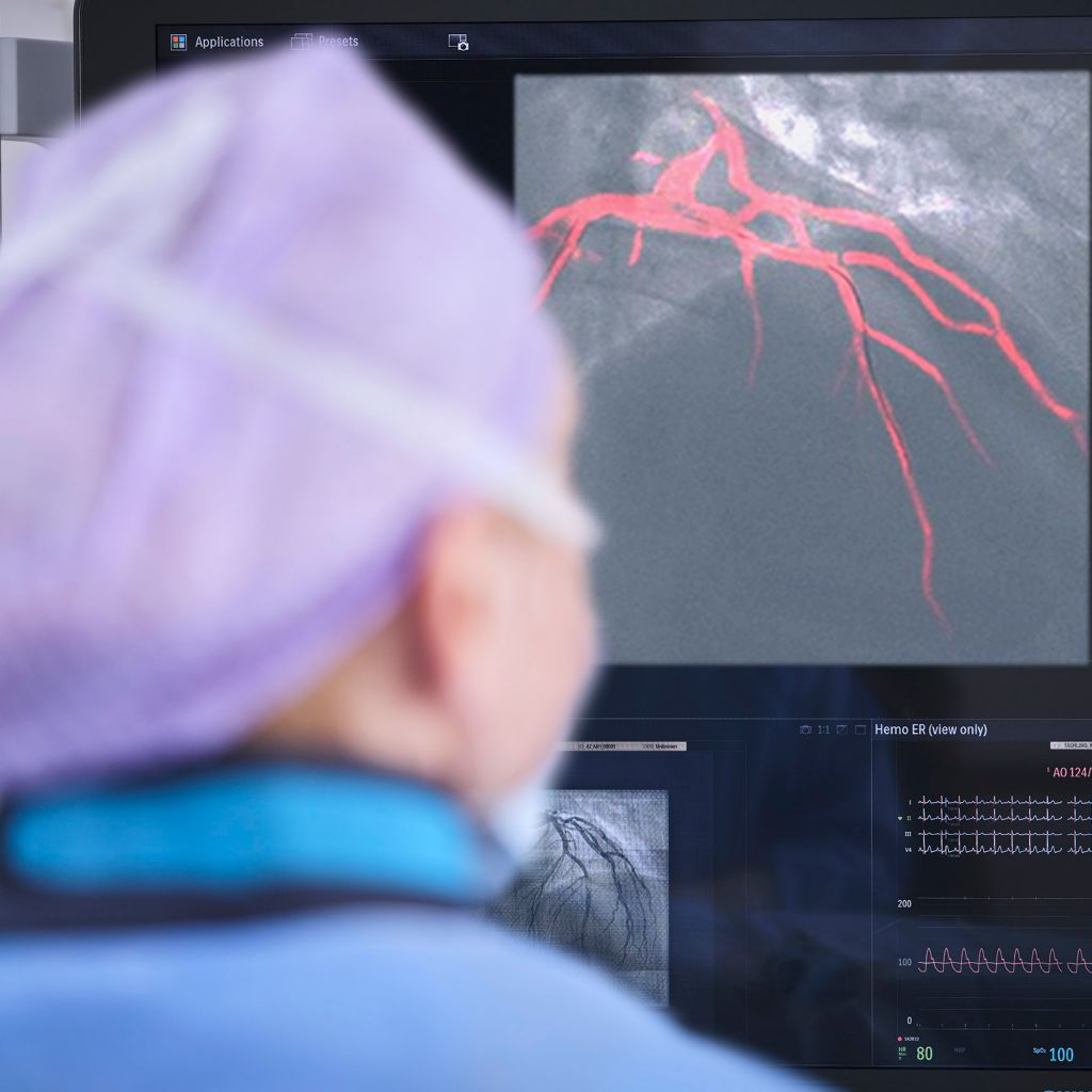 Clinician performing interventional procedure using Dynamic Coronary Roadmap