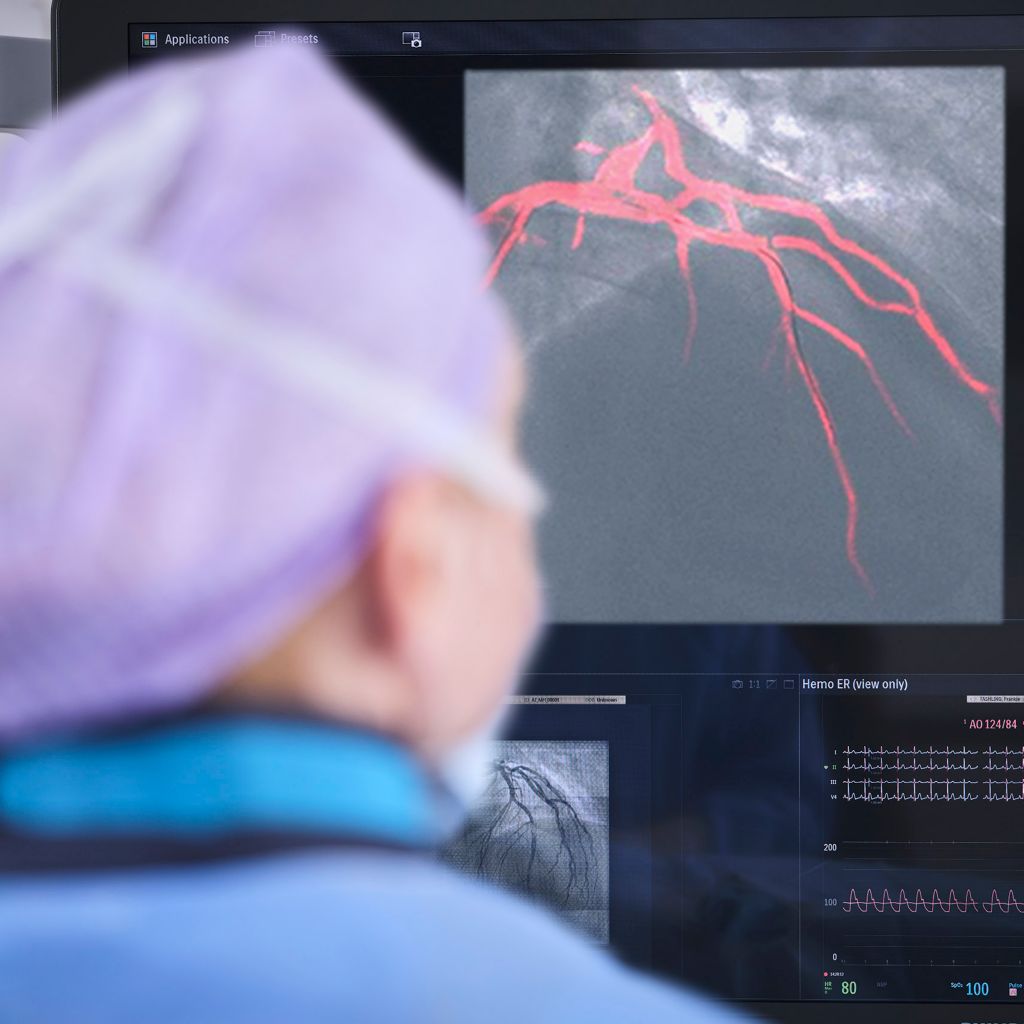 Clinician performing interventional procedure using Dynamic Coronary Roadmap