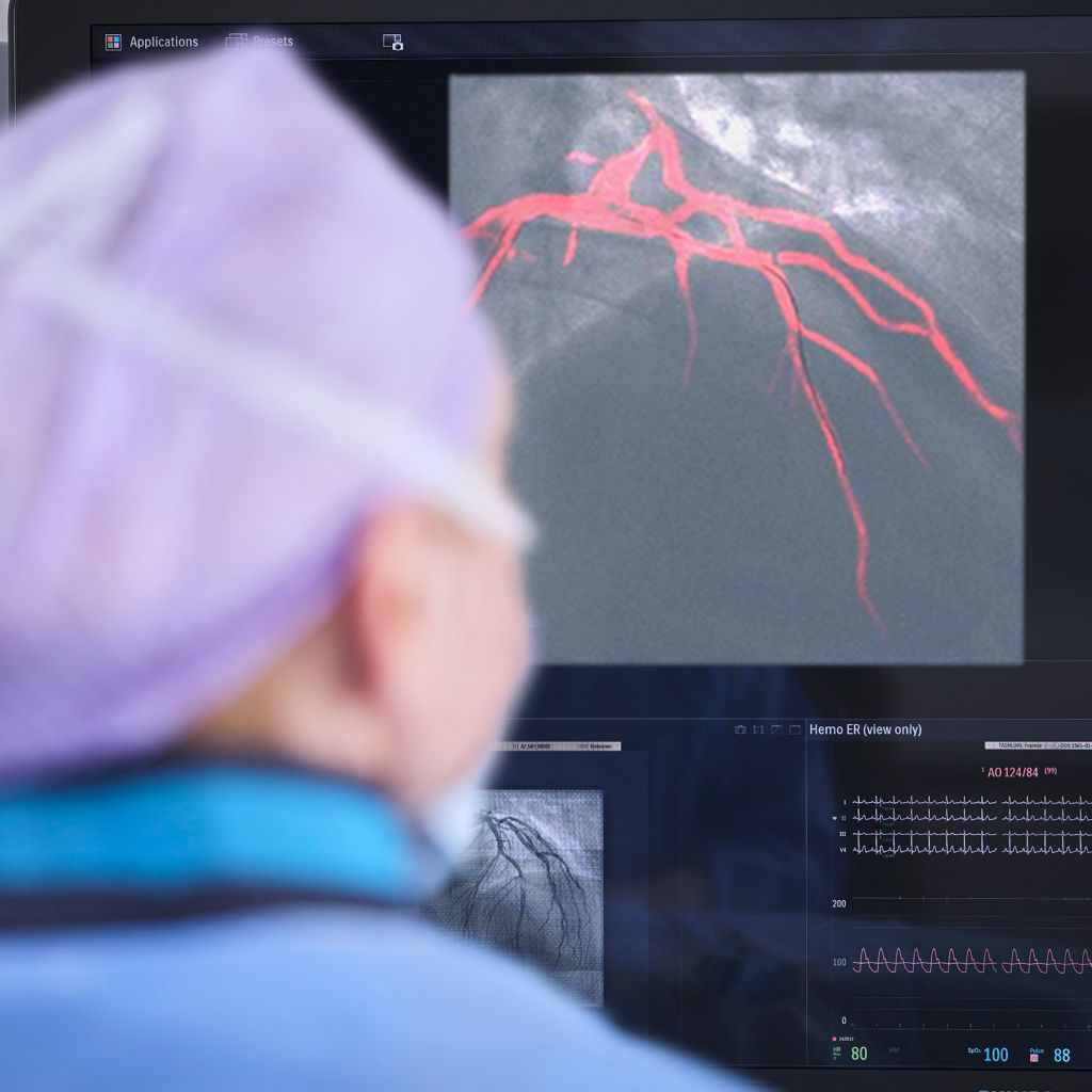 Dynamic Coronary Roadmap Philips