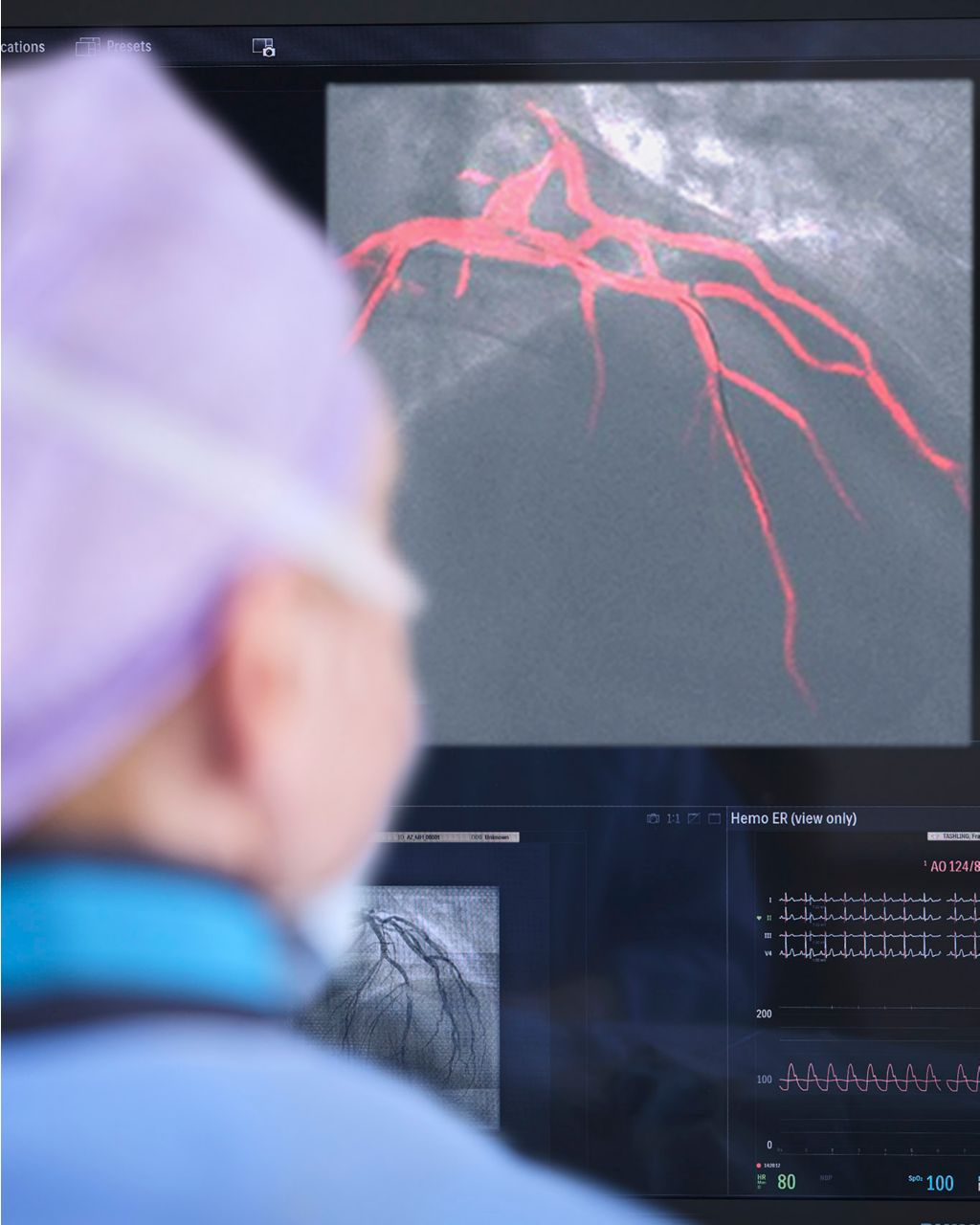 Dynamic Coronary Roadmap Philips Azurion