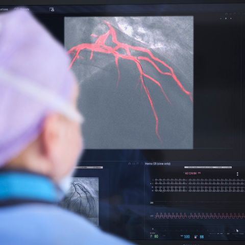 Dr Strobel dynamic coronary road map