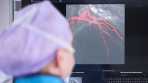 Angiogram result analysis