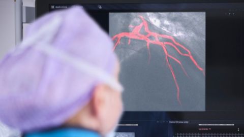 Coronary artery measurements