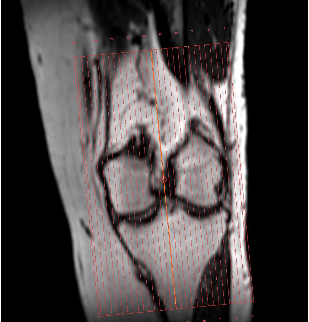 SmartExam Knee