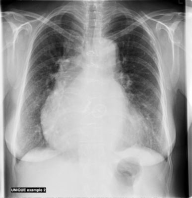 Philips Digitaldiagnost デジタルx線一般撮影システム