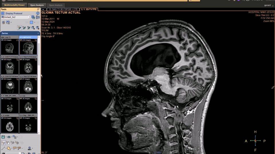 Pediatric MR imaging webinar