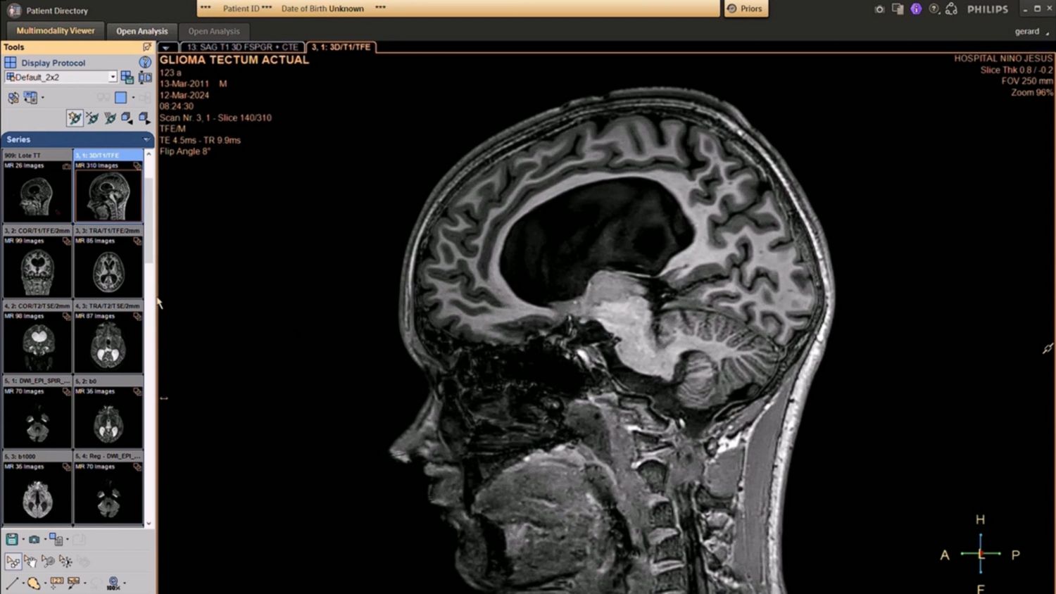 Pediatric MR imaging webinar