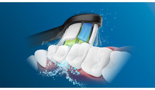 Philips Sonicare's advanced sonic technology