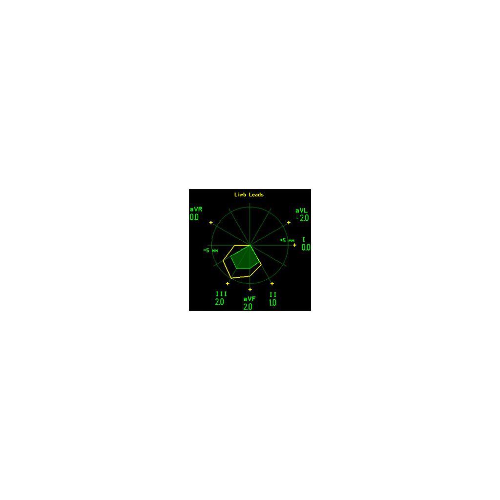 ST mapping visualisation
