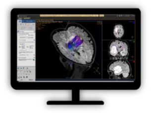 MR FiberTrak Visualize white matter connectivity in the brain​