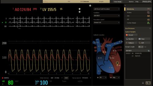 User interface - TAVI control room