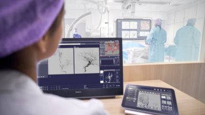 Médico revisando imágenes neurovasculares en el sistema Philips Azurion