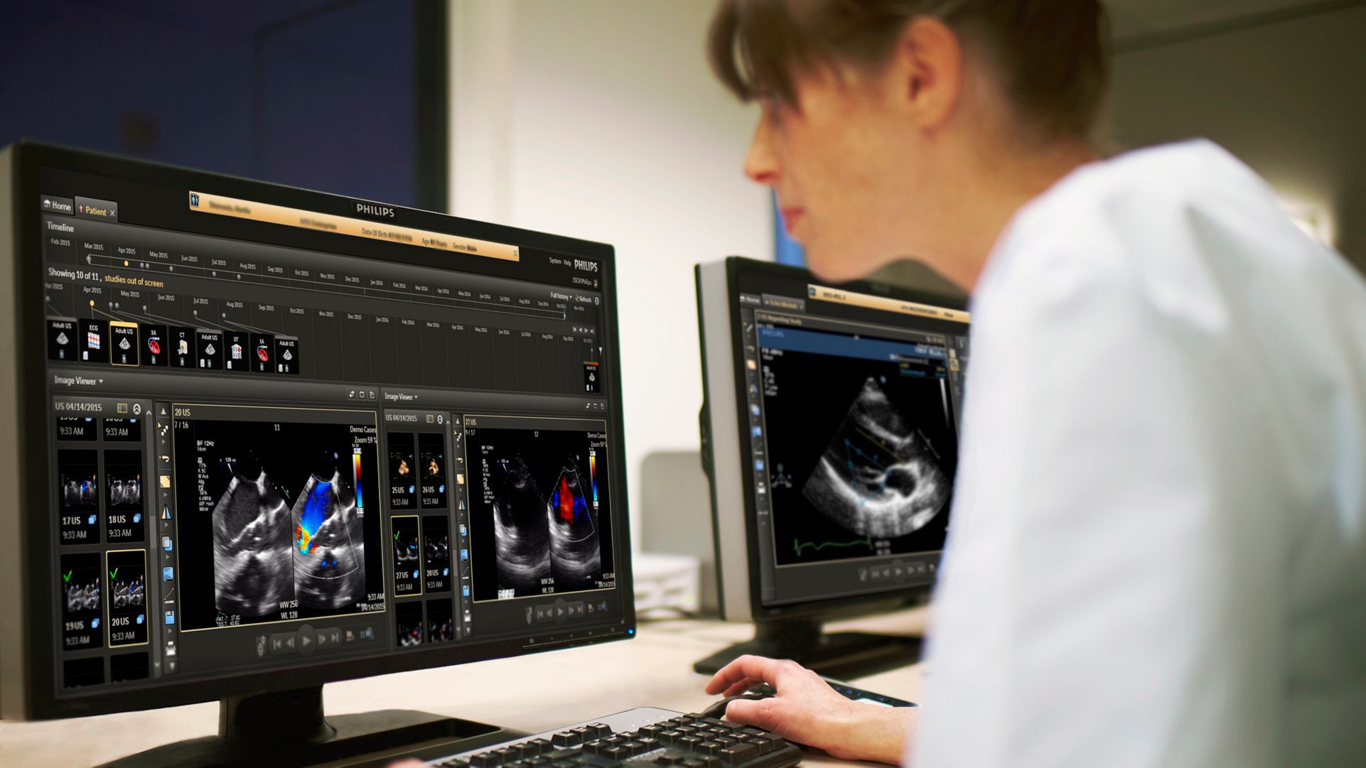 Cardiologists reviewing screens