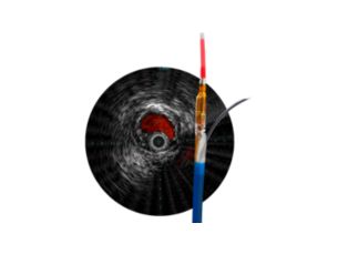 Pioneer Plus IVUS-guided re-entry catheter