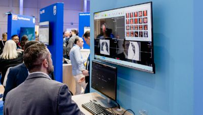 Profissional de saúde visualizando software de imagem médica durante o evento Philips ConnectDay