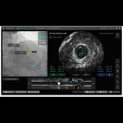 Tri-Registrierung am neuen IntraSight plus