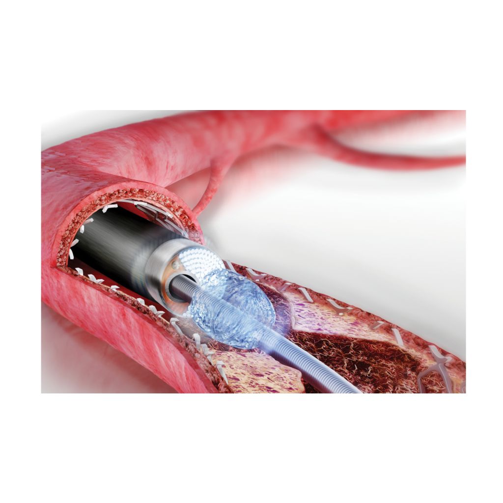 Peripheral procedures