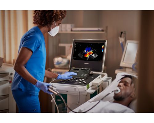 Compact Ultrasound 5500CV