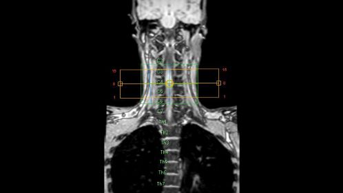 SmartExam Spine