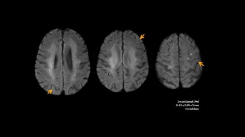 SmartSpeed Brain