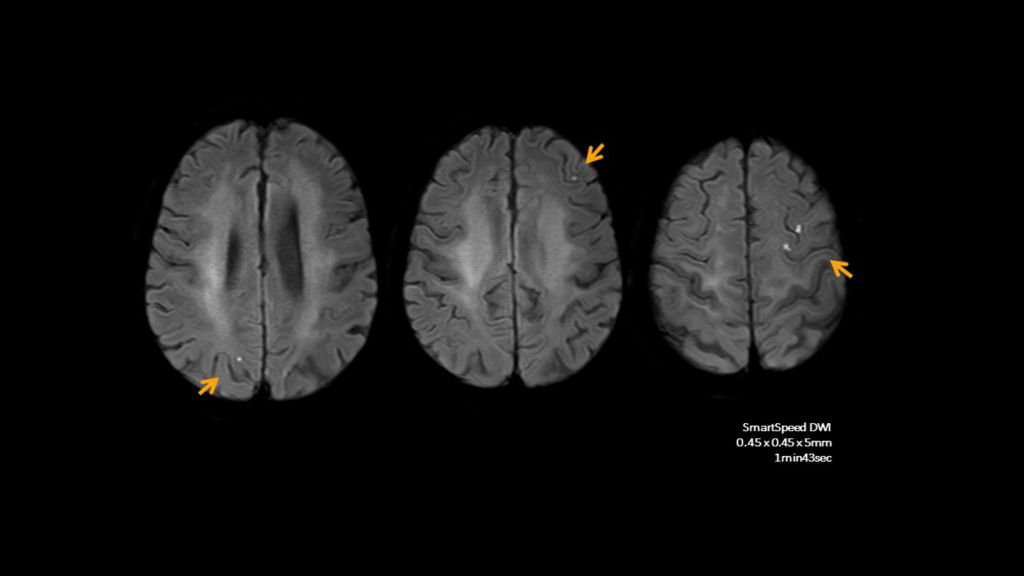 SmartSpeed Brain