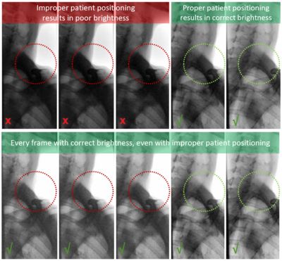 Brightness stabilization