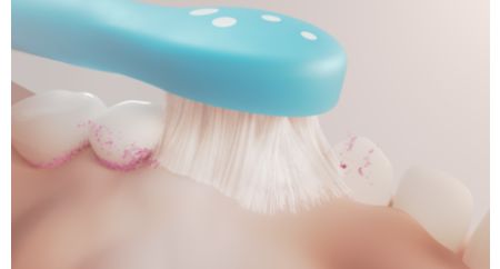 Un nettoyage en douceur pour protéger les dents des enfants