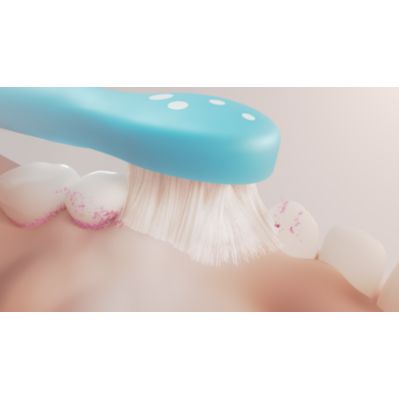 Sonicare Brush Heads Portfolio  Feature Image (PPL) Prevent kids' cavities