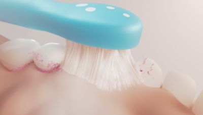 Gentle cleaning to protect growing smiles