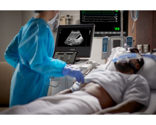 Compact Ultrasound 5300 series