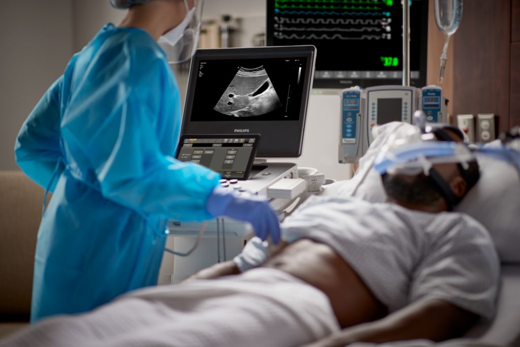 Compact Ultrasound System 5000 series GI with C5-1